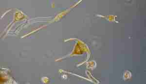 Mikroskopisk bilde av planteplankton med ulike former