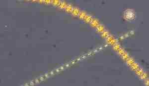 Mikroskopbilde av kisealge