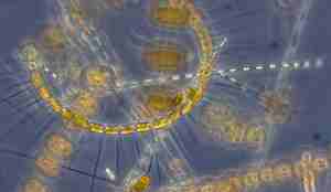 Mikroskopbilde av kisealge