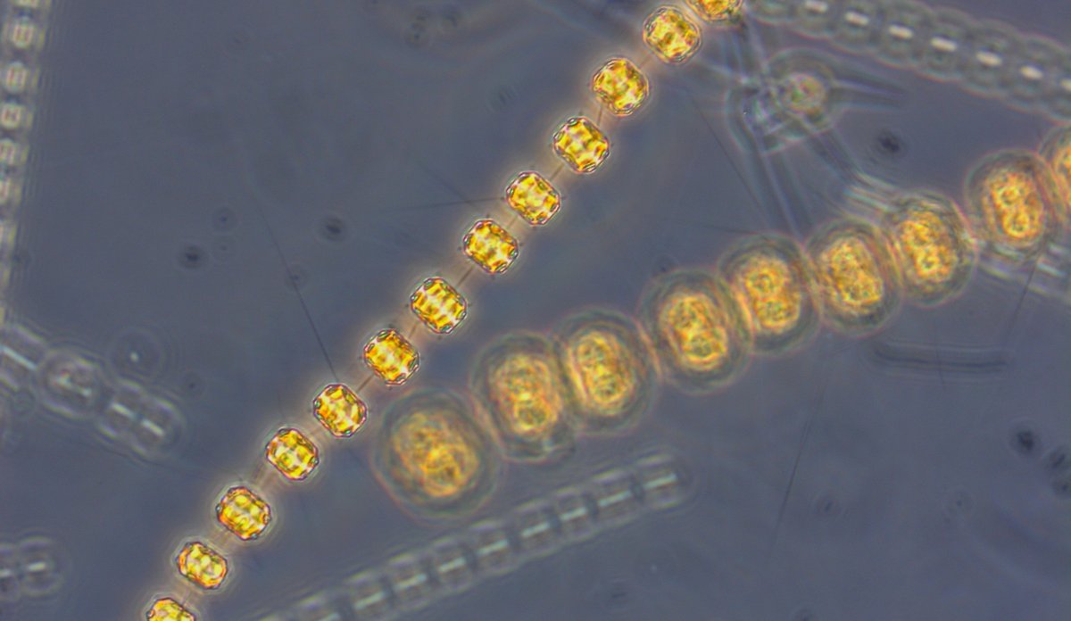 Mikroskopbilde av kisealge