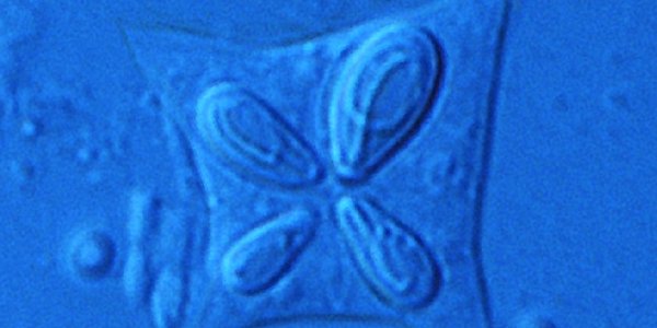 

Gelémakrell-parasitten Kudoa thyrsites (10 µm)