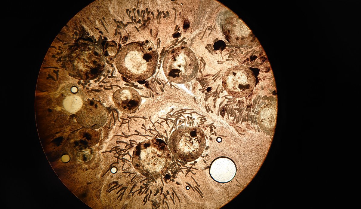 
Hvilesporer og hyfer i en makrellnyre sett gjennom et mikroskop