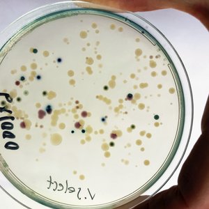 vibrio