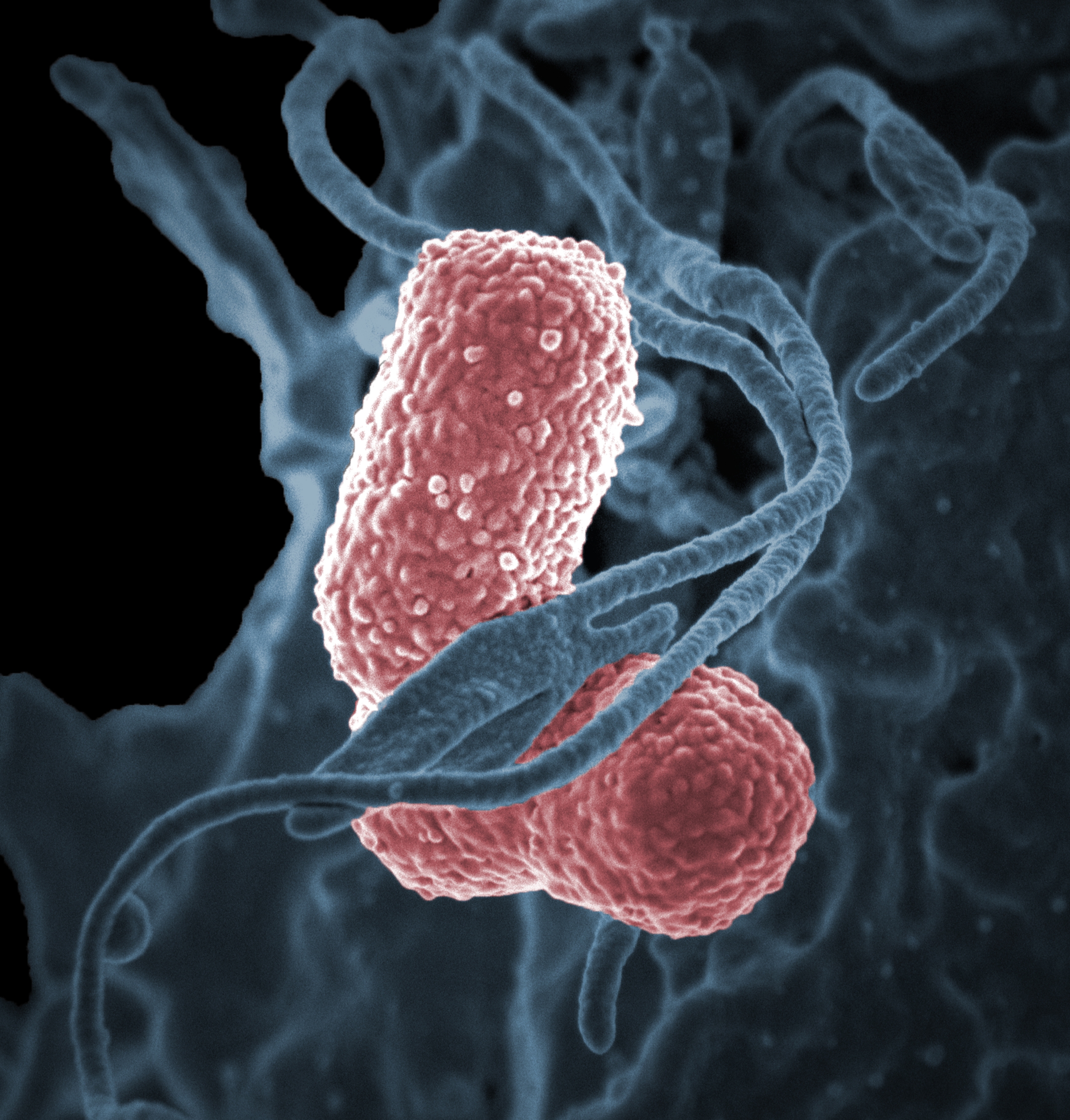 Klebsiella pneumoniae (rosa) er en hyppig årsak til flere ulike infeksjonssykdommer. 