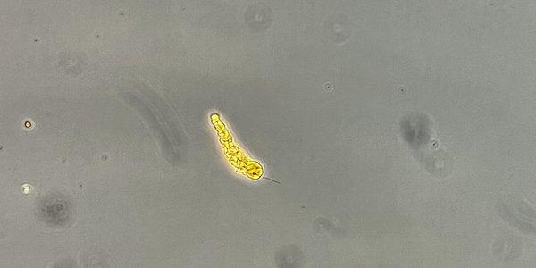 

Todelt bilde som viser en alge på eine sida og en person på andre.