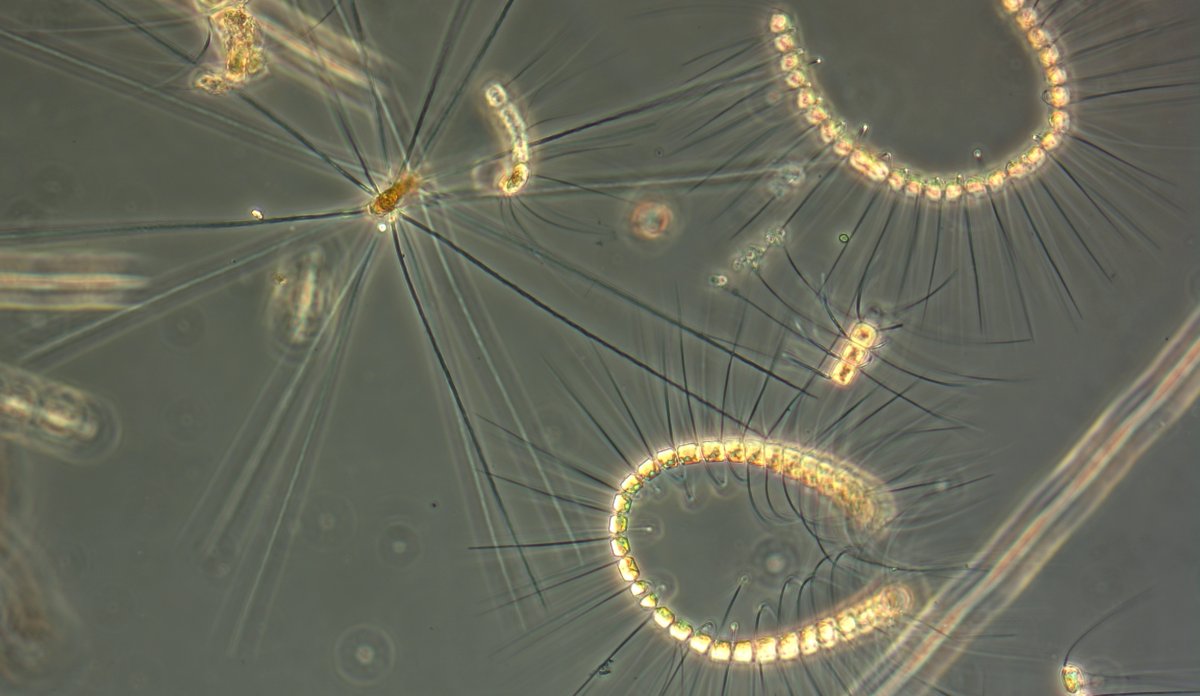
Trådformede alger sett i mikroskop.