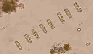Mikroskopbilde av åtte små rektangler etter hverandre