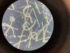 Mikroskopbilder av alger som ser ut som trådformede staver 