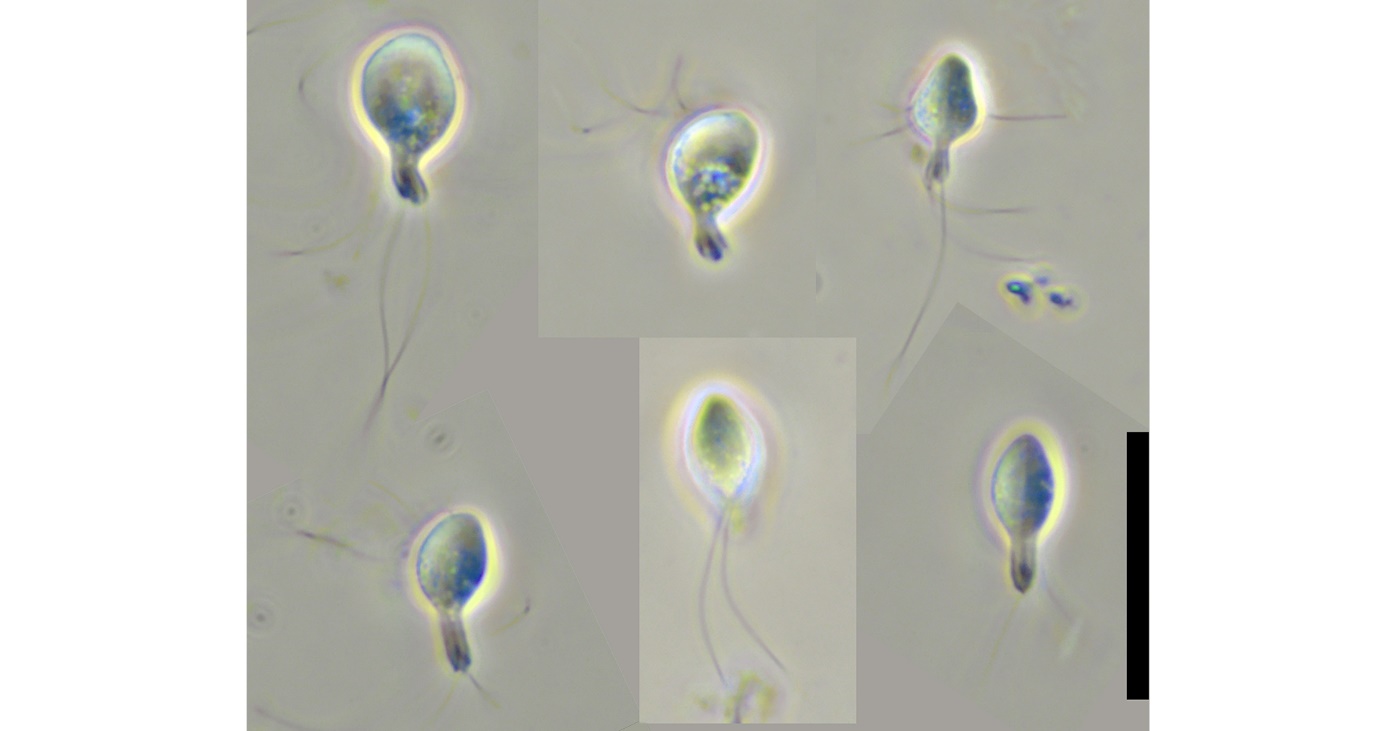 Levende Spironucleus salmonicida.