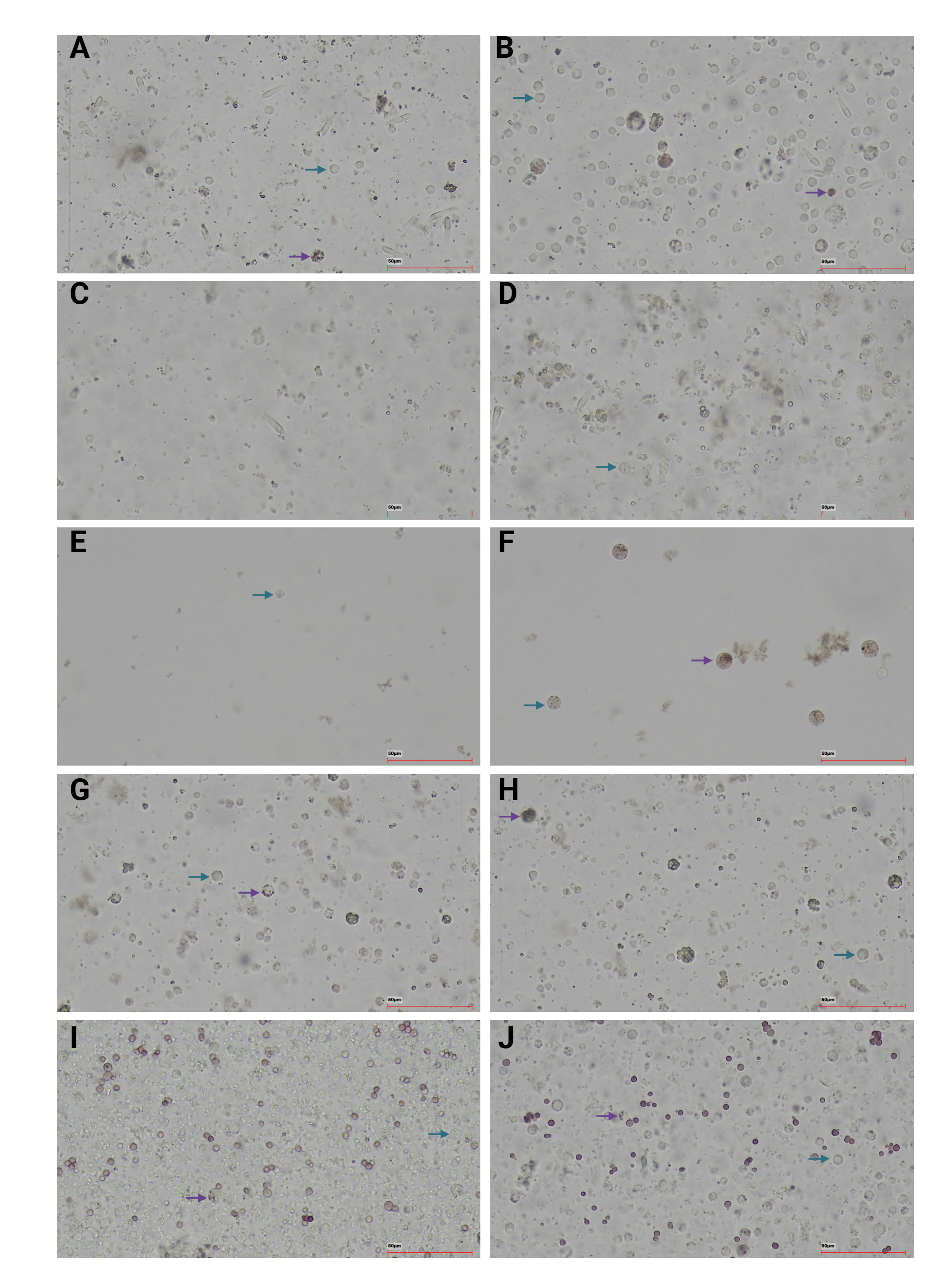 Satt sammen av ti bilder, to og to nedover med bokstevene A til J, A øverst til venstre og J nederst til høyre. 