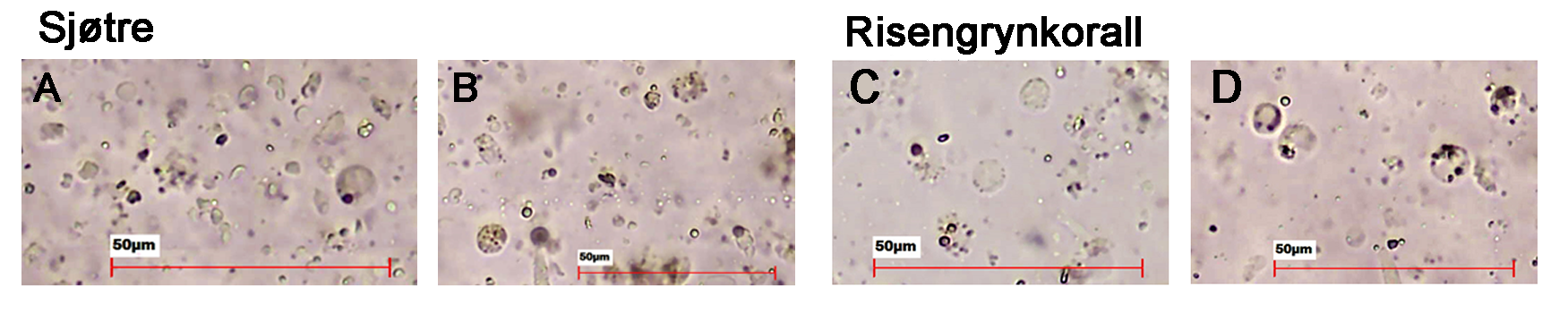 Størrelse angitt i hvert bilde med rød strek som viser 50 um. Alle bildene viser ulik mengde lysosomalceller. 