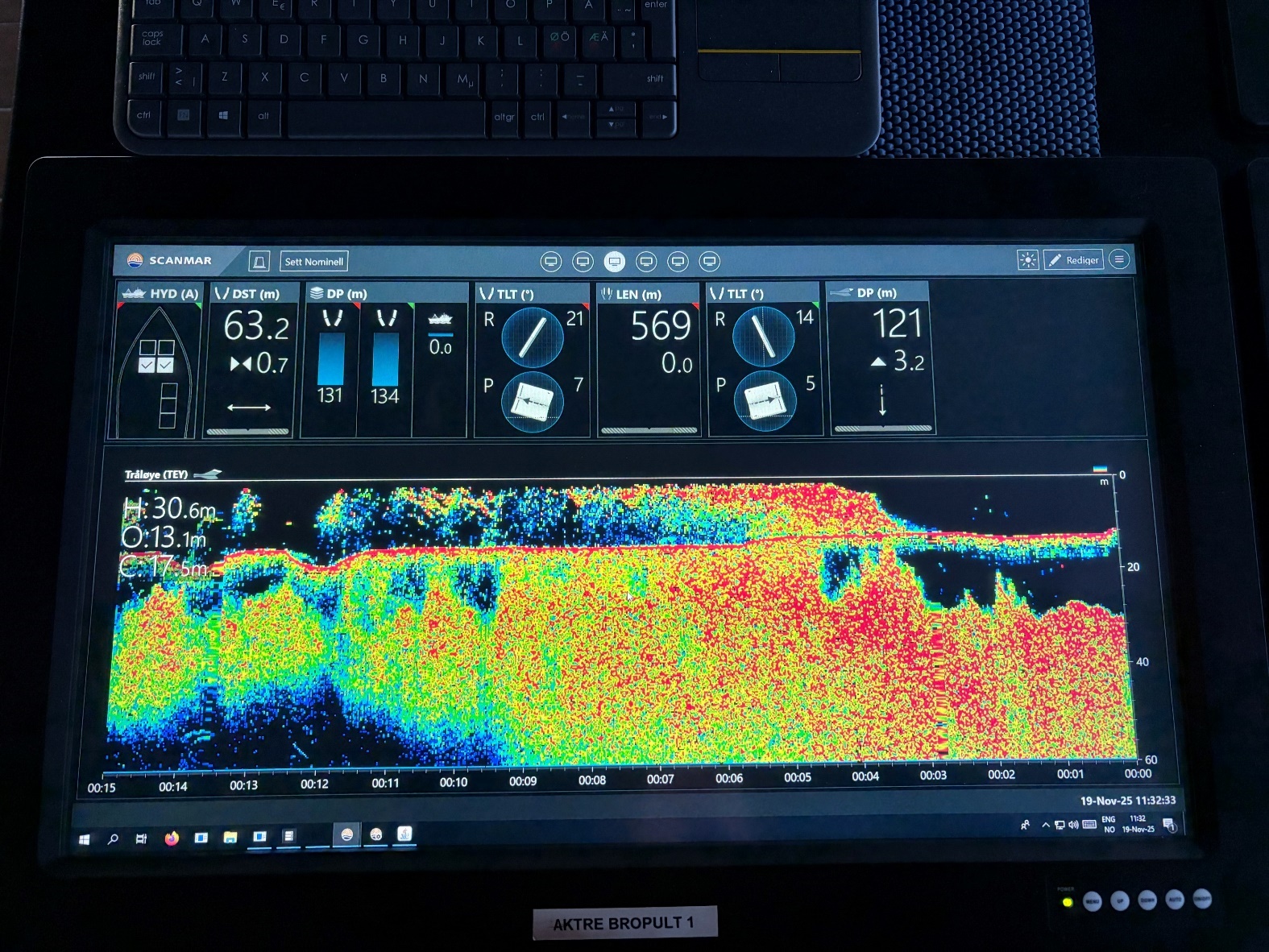 Ekkogram fra tråløye.