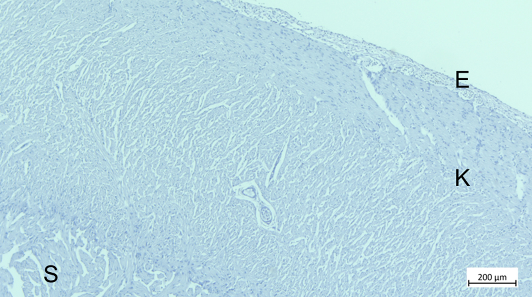 Histologisk snitt av hjerteventrikkel 