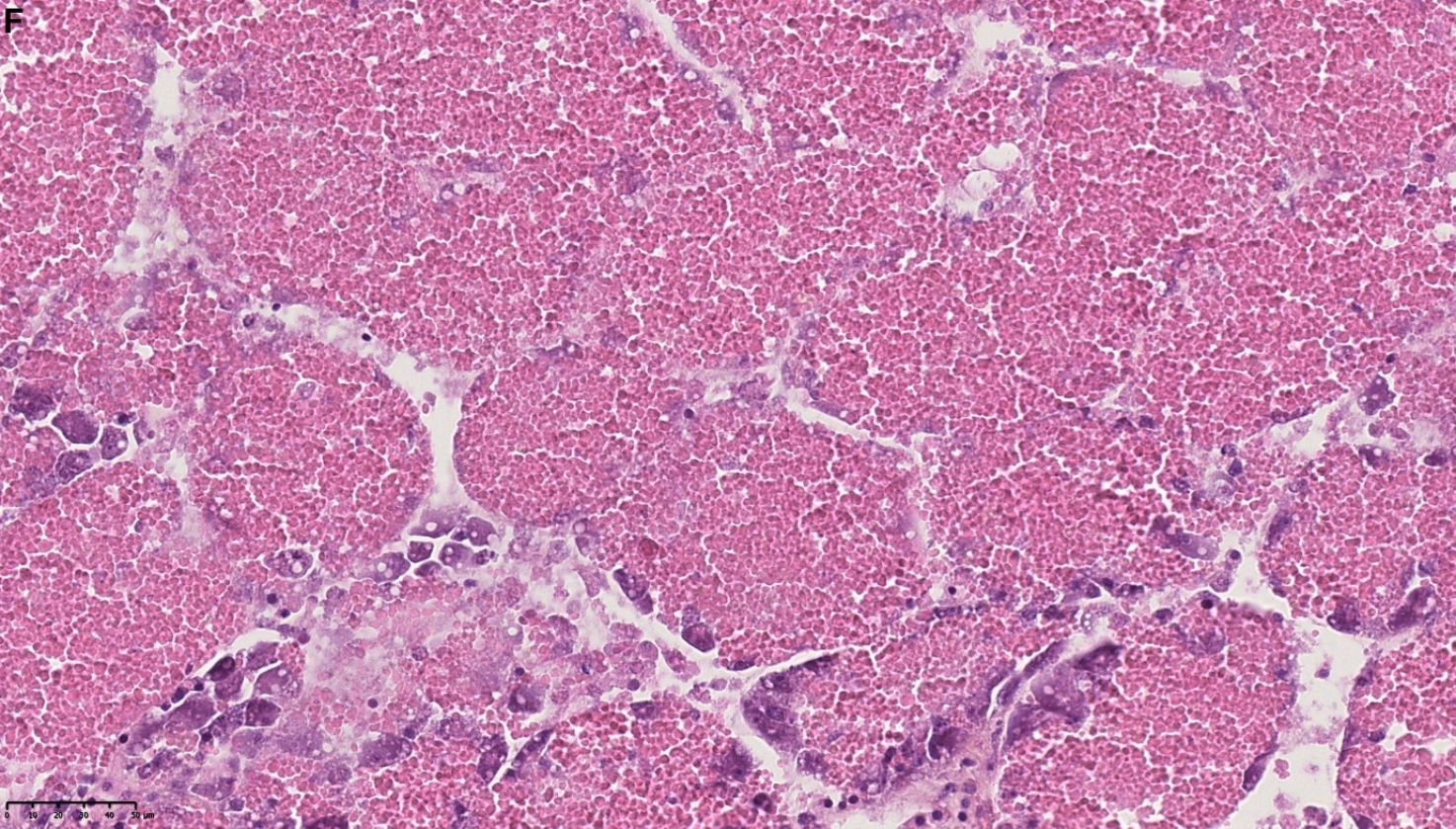 Figure 1. F) Autolysis of the entire structure of DD. Note the disappearance of the basal membrane and the basophilic cells. HES stained. NDP view 2, 40X. 