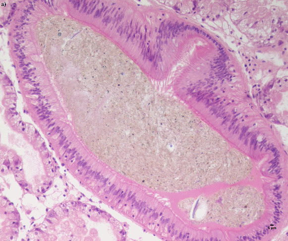 Figure 2. a) Debris in the gut, NDP view 2, 40x (HAMATSU Photonics)