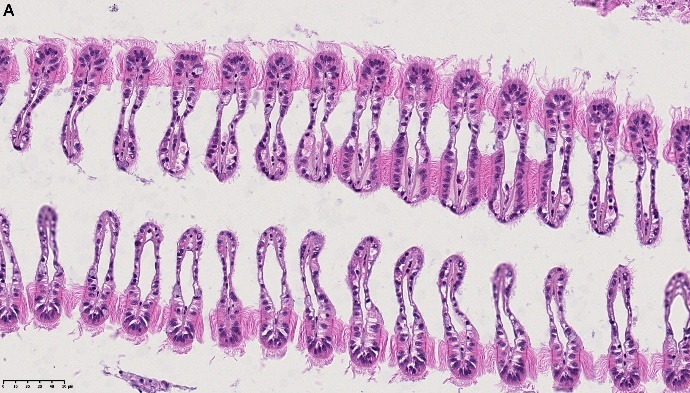 Figure 3. A) Normal gill. NDP view 2, 40x (HAMATSU Photonics)