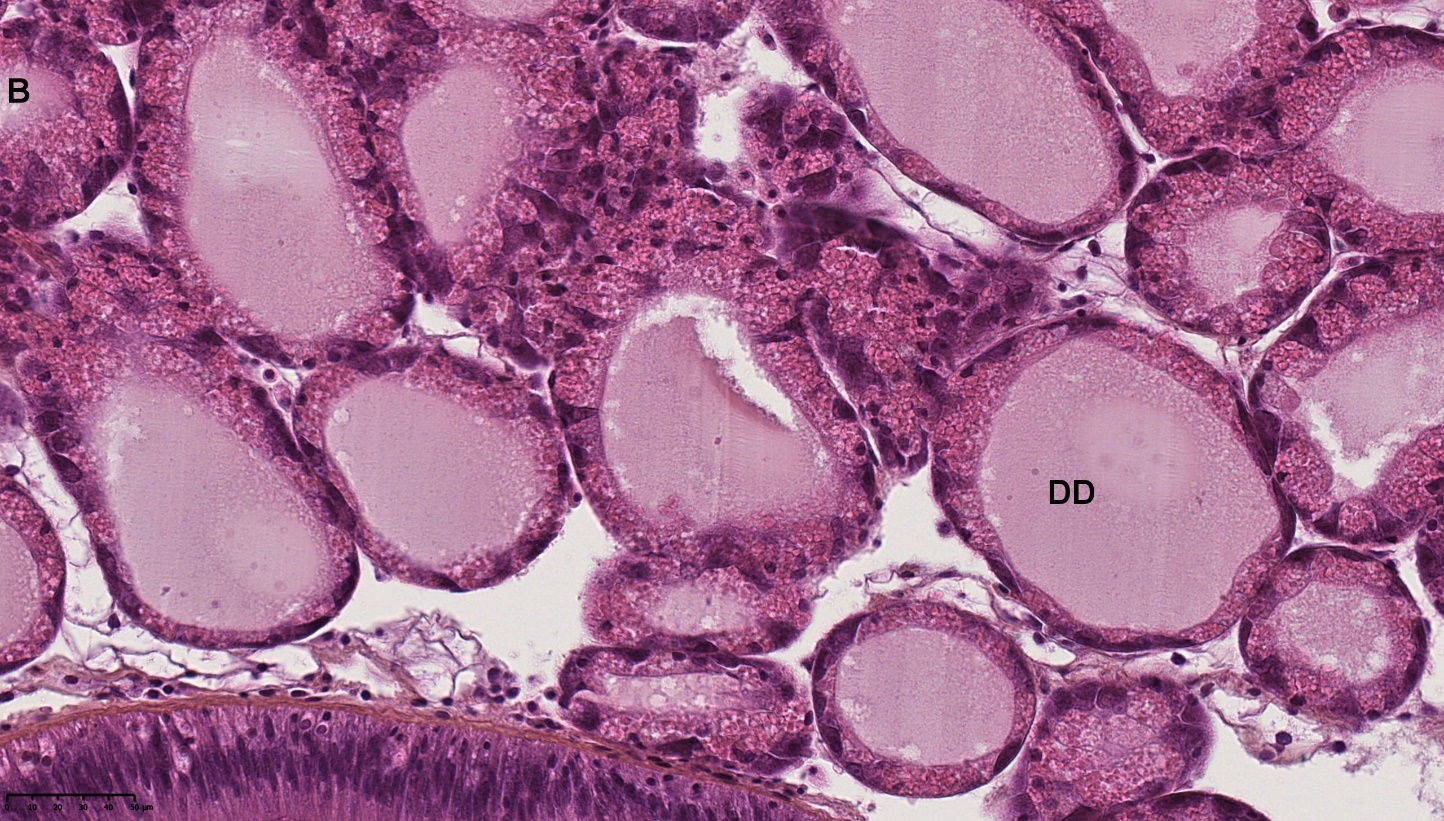 Figure 1. B) Atrophied DD. HES stained. NDP view 2, 40X. 