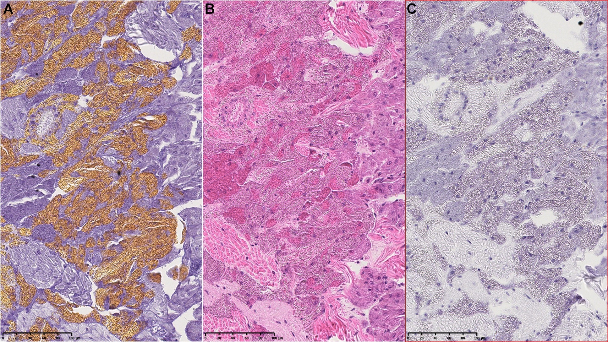 Figure 7.  Three parallel sections of mussel foot from Hardangerfjorden stained with:  A) rhodanine using the microwave method (golden brown color), B) hematoxylin and erythrosine, C) hematoxylin only. NDP view 2, 25x (HAMAMATSU Photonics).  