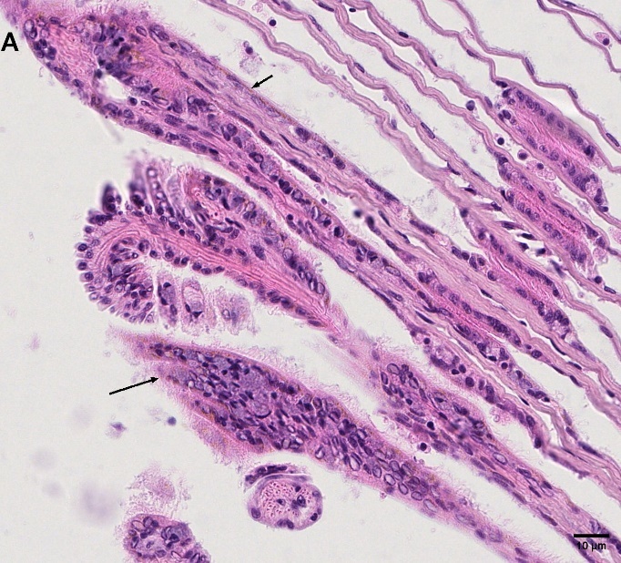 Figure 4. Gill with brown pigmentation (black arrows), 40X (Leica DRME), HES stained. NDP view 2, 40X (HAMAMATSU Photonics). 