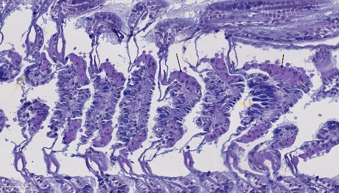 Figure 3. F) Same specimen as in figure 3E stained with AB – PAS. The secretary cells are slightly PAS positive (black arrows), while the acidic mucins are AB positive (orange arrows). NDP view 2, 40X (HAMAMATSU Photonics). 