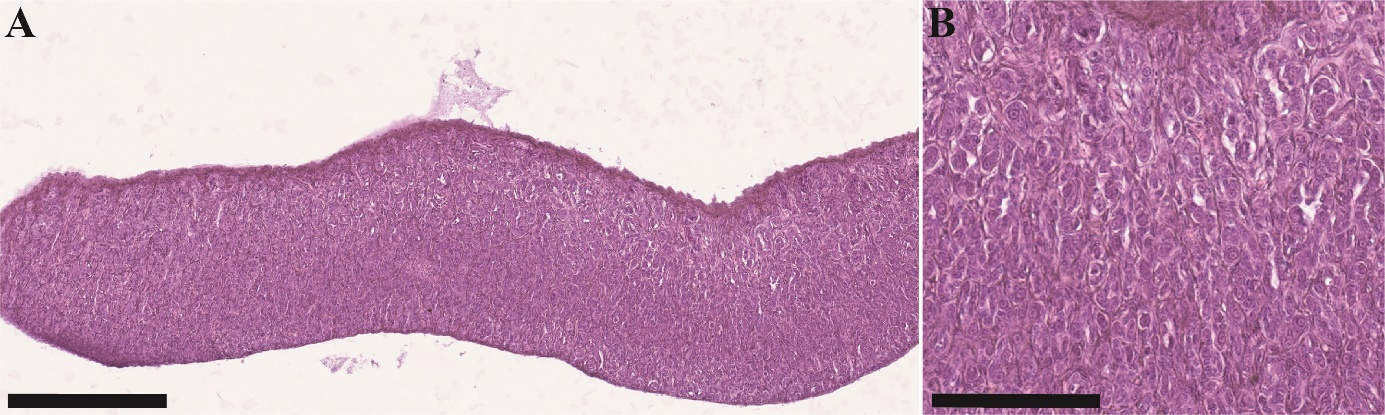 Figuren viser to bilder av histologiske lysbilder av gonadevev fra hanntorsk i forskjellige forstørrelser. I denne umodne fisken observeres spermatogonia.