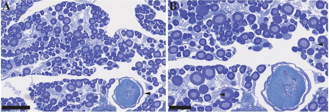 Figuren viser to bilder av histologiske lysbilder av gonadevev fra hunntorsk i forskjellige forstørrelser. Previtellogene oocytter observeres på bildene, med noen oocytter i atresi. I tillegg er det mange follikler etter ovulering. Fisken avslutter gyting.