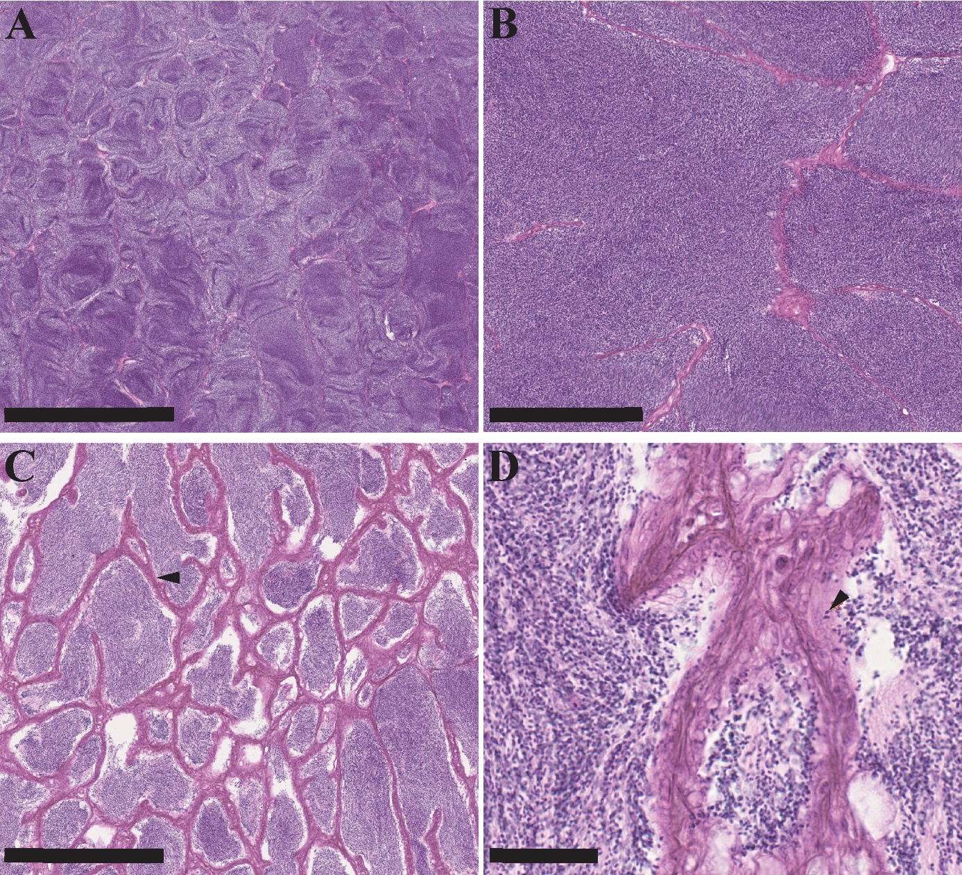 Figuren viser fire bilder av histologiske lysbilder av gonadevev fra hanntorsk på forskjellige steder i vevet og i ulike forstørrelser. Bildene viser hovedsakelig spermatozoer, men også fagocyterte frie spermatozoer og tykke vegger kalt interlobulære vegger. Fisken er i 3. stadium: gytende hanntorsk.