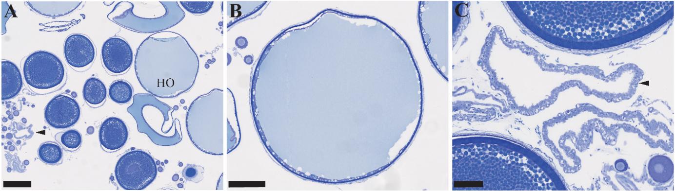 Figuren viser tre bilder av histologiske lysbilder av gonadevev fra hunntorsk i forskjellige forstørrelser. Store hydrerte oocytter og follikler etter ovulering observeres på bildene. Fisken gyter.