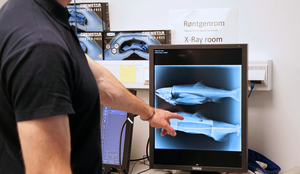 Bildet av en mann som viser et røntgenbilde av pukkellaks