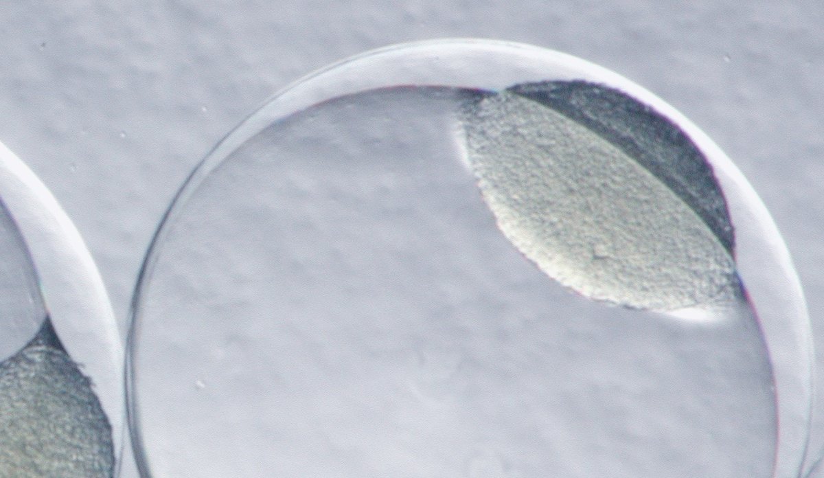 
Mikroskopbilde av et torskeegg
